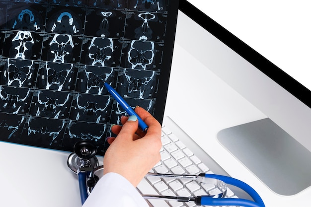 Doktor, der Computertomographie-Röntgenbild betrachtet. Arbeitstisch des Medizinarztes mit Computer und Stethoskop. Gesundheitskonzept