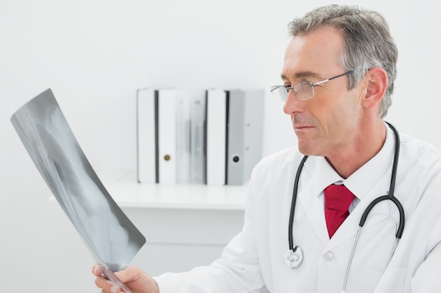 Doktor, der Röntgenstrahlbild von Lungen im Büro betrachtet