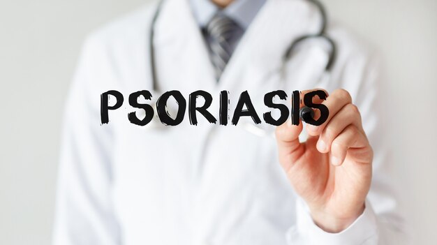 Doktor, der Wort Psoriasis mit Marker, medizinisches Konzept schreibt