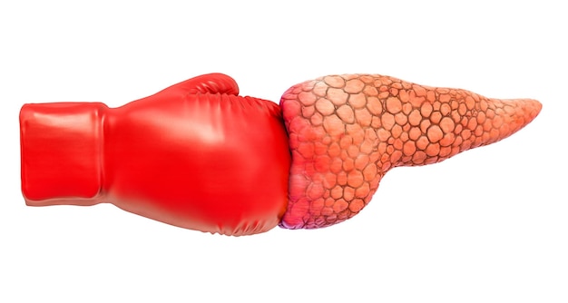 Dolor pancreático Páncreas con guante de boxeo renderizado 3D
