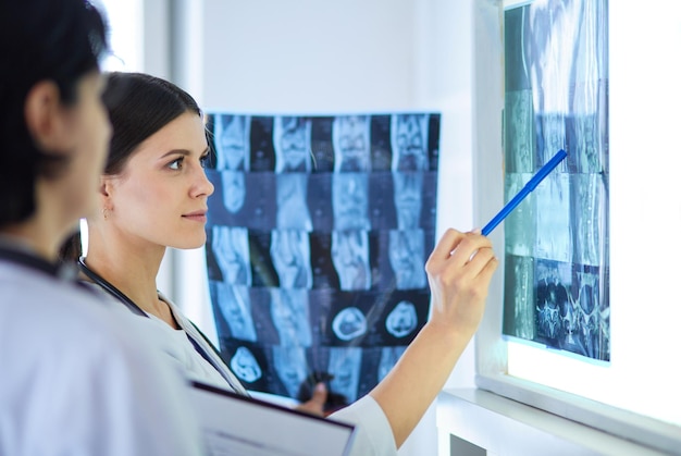 Dos doctoras señalando radiografías en un hospital