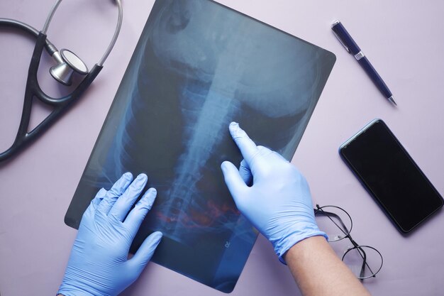 Doutor espera analisando fotografia de raio X close-up