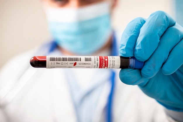 Doutor, segurando a amostra de sangue do tubo de ensaio