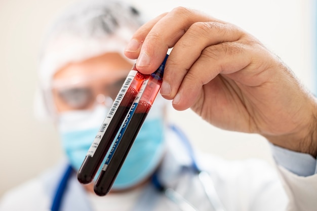 Doutor, segurando a amostra de sangue do tubo de ensaio