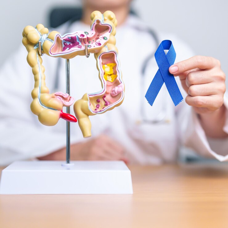 Foto doutor segurando fita azul com modelo de anatomia do cólon humano march colorectal cancpt