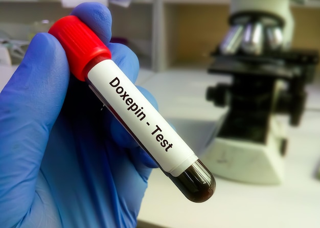 Doxepin-Level-Tests zur Aufrechterhaltung der therapeutischen Dosis und Toxizität