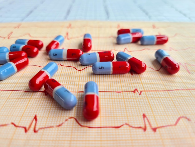 ECG com ritmo de estimulação ventricular de marcapasso artificial com comprimidos na mesa