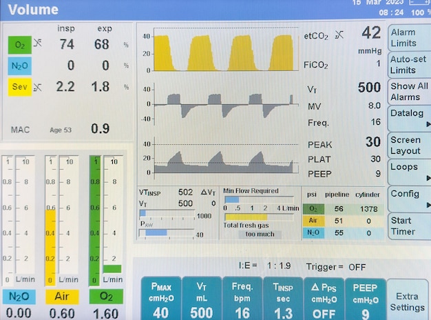 Ein Computerbildschirm zeigt einen Hochdruck-Durchflusstest.