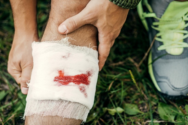 Ein junger Tourist mit einem Verband verbindet die Verletzung an seinem Bein auf dem Weg zum Camp