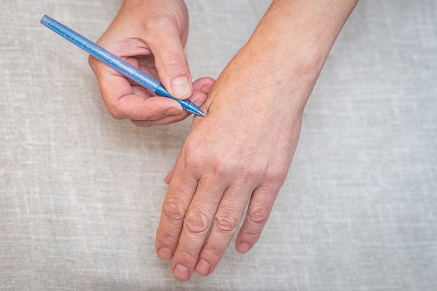 Ein Kreuz am Arm als Andenken an eine ältere Frau.