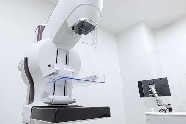 Ein Mammographiegerät mit Computerarbeitsplatz in der Radiologieabteilung.