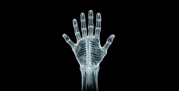 ein Röntgenbild einer Hand, bei dem alle Knochen sichtbar sind