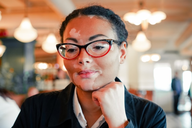 Ein schönes junges mädchen afrikanischer abstammung mit dem vitiligo, das in einem restaurant sitzt