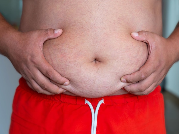 Foto ein übergewichtiger mann in roten shorts hält seinen dicken bauch für das konzept der notwendigkeit von sport und richtiger ernährung