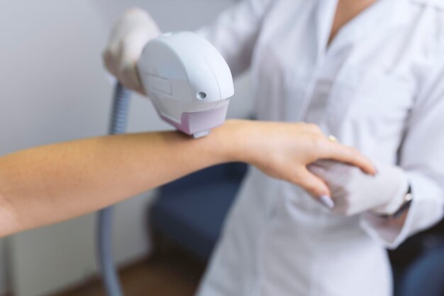 Eine Frau entfernt in einem Schönheitssalon mit Laser-Epilation Haare von ihrem Arm
