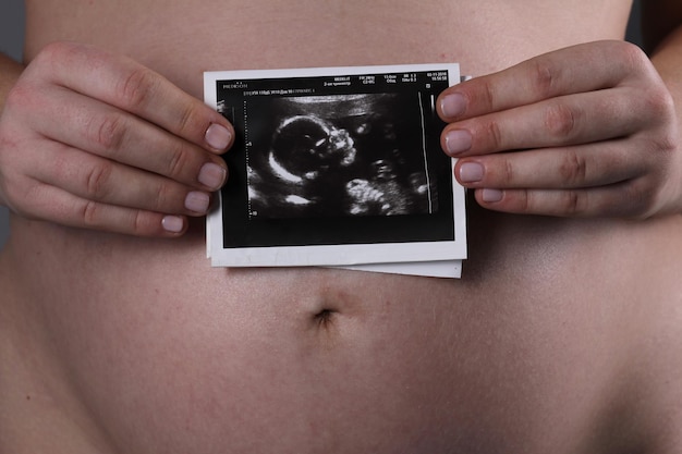 Eine schwangere Frau hält das erste Ultraschallfoto ihres Babys vor dem Hintergrund ihres Bauches in ihren Händen