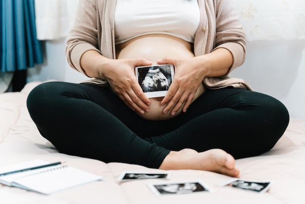 Eine schwangere Frau im Kleid mit Ultraschallbild Werdende Mutter wartet und bereitet sich auf die Geburt eines Babys während der Schwangerschaft vor