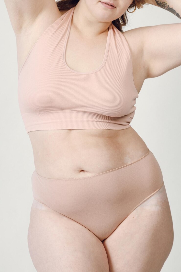 Eine übergewichtige Plussize-Frau mit Dehnungsstreifen auf der Haut, die in weißer Unterwäsche steht.