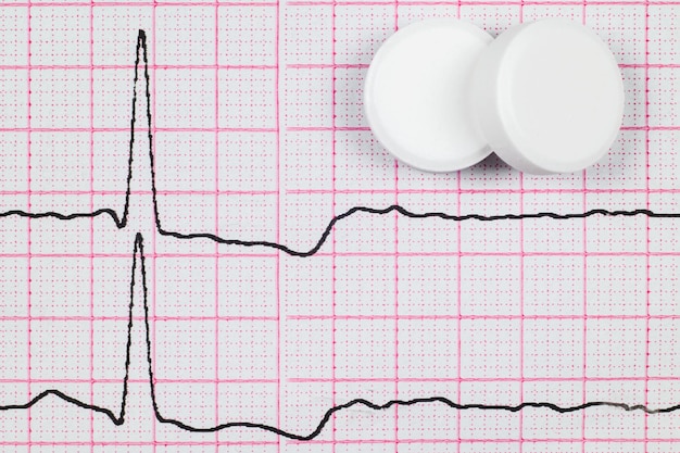 EKG Myokardischämie auf dem EKG und Pillen in der NäheAnginaBrustschmerzenNahaufnahme