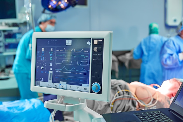 Electrocardiograma en cirugía hospitalaria que opera la sala de emergencias que muestra la frecuencia cardíaca del paciente con desenfoque de fondo del equipo de cirujanos