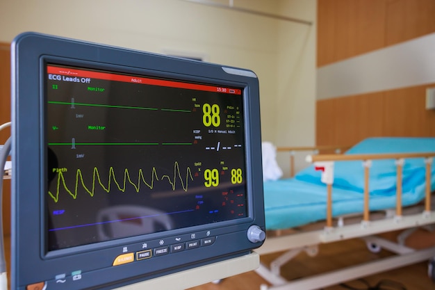 Foto elektrokardiogramm-ekg-herzfrequenzmonitor im krankenhauszimmer zur überprüfung der herzfrequenz von krankenhauspatienten