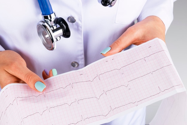 Foto eletrocardiograma, ecg na mão de uma médica. assistência médica à saúde. ritmo cardíaco de cardiologia clínica e close up de teste de pulso. impressão do eletrocardiograma.