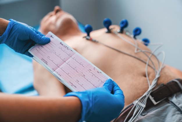 Foto eletrocardiograma ecg na mão impressão de cardiograma no fundo do paciente masculino