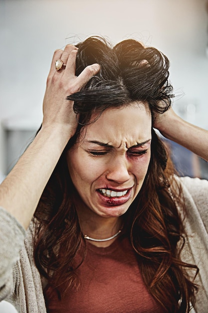 Ella no puede soportarlo más Foto de una joven golpeada y magullada llorando con las manos en el cabello