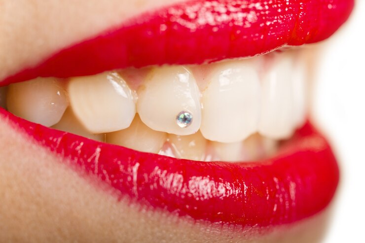 empalmar los dientes