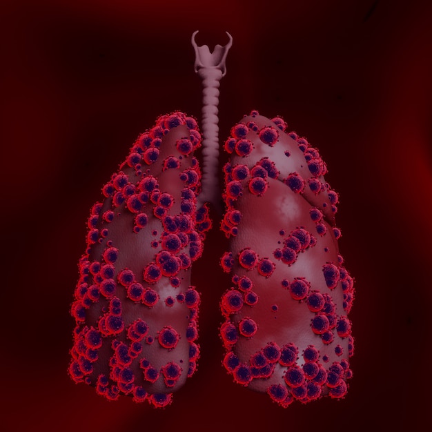 Enfermedad pulmonar con Covid 19, Coronavirus 2019-n, Vista microscópica de las células flotantes del virus de la influenza. Representación 3d