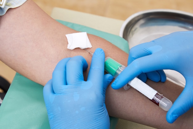 Foto enfermeira colhendo amostra de sangue para fazer exame em laboratório