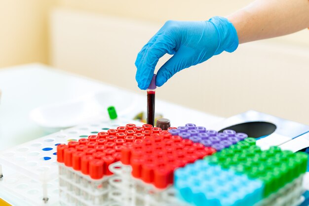 Enfermeira coloca amostras de sangue em tubos em um rack especial sobre uma mesa. as mãos do médico em luvas de látex azuis colocam o tubo de ensaio em um rack com muitos frascos coloridos em laboratório. fechar-se.