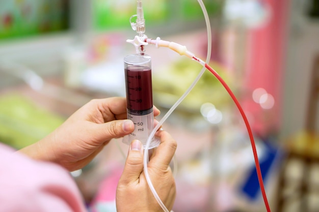 Enfermeira mãos está ajustando a seringa para tirar sangue do saco de sangue.