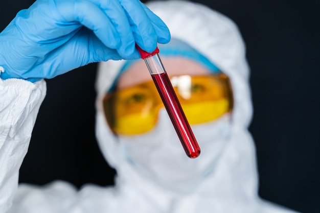 Enfermeira segurando o tubo de ensaio com amostra de sangue de teste de coronavírus positivo. 2019-ncov pandemia, novo coronavírus chinês, conceito de análise de sangue de wuhan coronavirus.