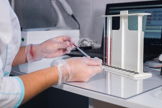 Enfermera de la clínica médica en su lugar de trabajo llenando la pipeta con sangre del tubo