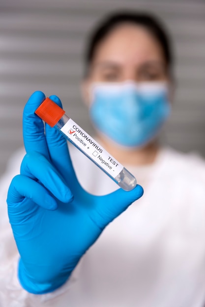 Foto enfermera irreconocible mostrando un tubo de ensayo con una muestra positiva de virus