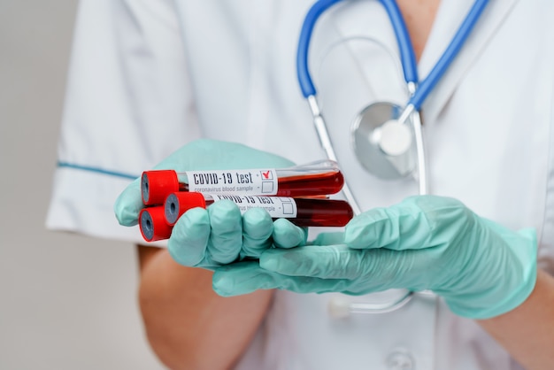 Foto enfermera con máscara protectora y guantes y sosteniendo un tubo de análisis de sangre de virus