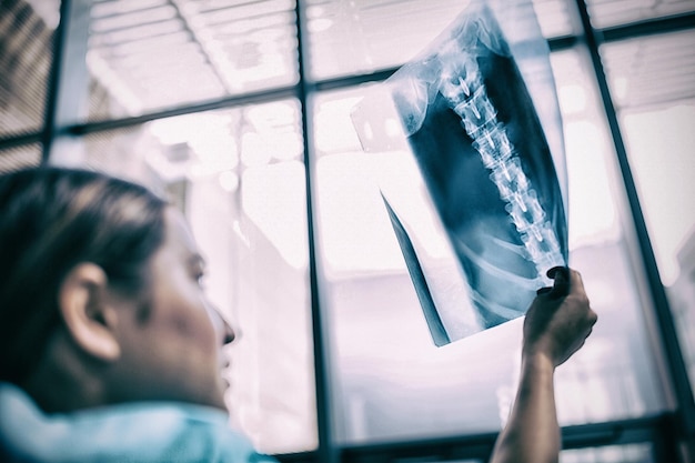 Foto enfermera que mira el informe de la radiografía