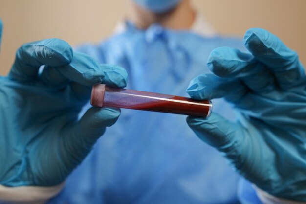 Una enfermera sostiene un tubo de ensayo con una muestra de sangre positiva para coronavirus 2019 nCoV pandemia MERS