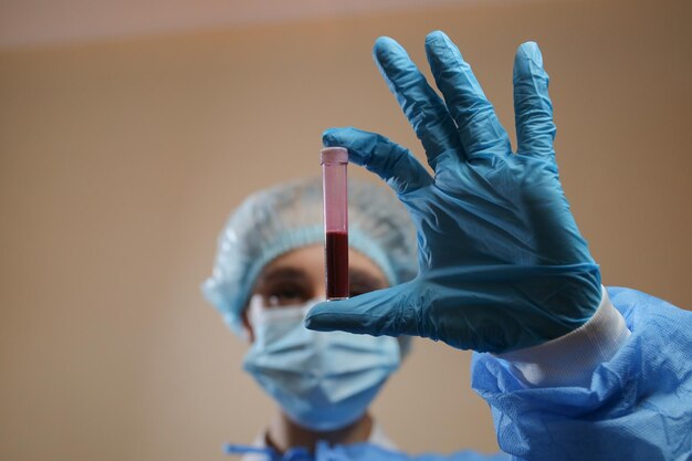 Una enfermera sostiene un tubo de ensayo con una muestra de sangre positiva para coronavirus 2019 nCoV pandemia MERS