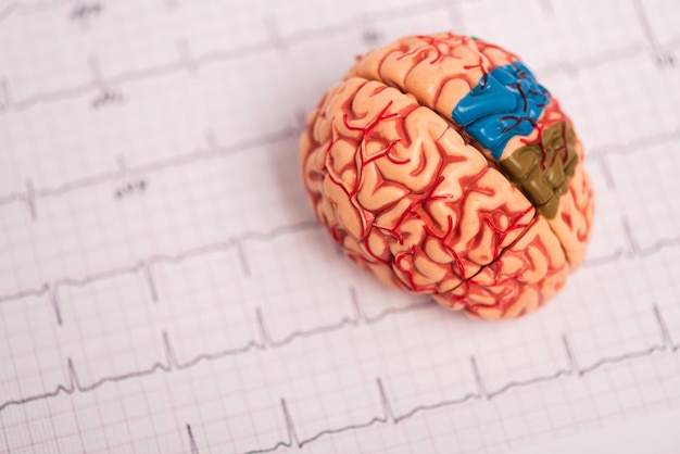 Enfoque selectivo del modelo cerebral con partes coloreadas en electrocardiograma aislado en blanco