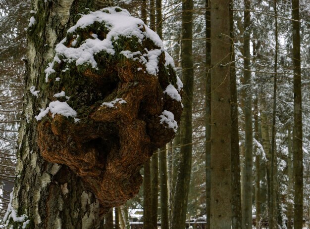 Un enorme tumor en el tronco de un árbol de abedul cubierto de musgo y nieve Crecimiento en un árbol enfermo