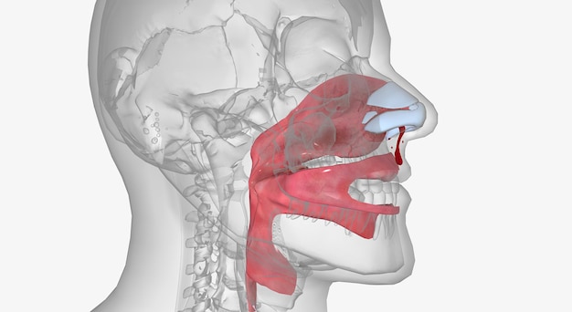 Foto la epistaxis es una hemorragia nasal causada por una lesión o que aparece espontáneamente.