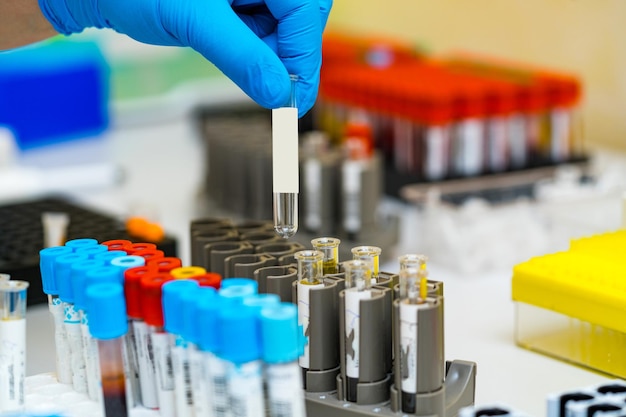 Equipamento de laboratório de microbiologia de análise médica de exames de sangue