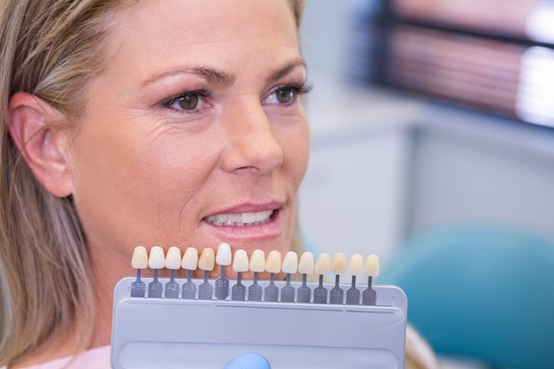 Equipo de blanqueamiento dental por paciente sonriente en clínica médica