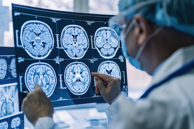 Un equipo diverso de médicos analizando escáneres cerebrales en una instalación médica moderna que se centra en el diagnóstico y la colaboración
