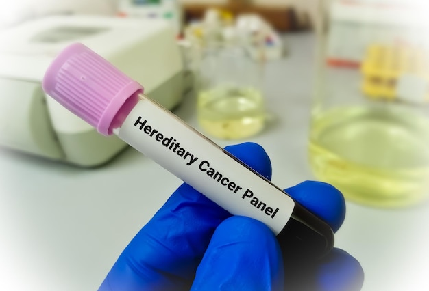 Erblicher Krebs-Paneltest, einschließlich des Nachweises von 47 Genen, die für Krebs verantwortlich sind.