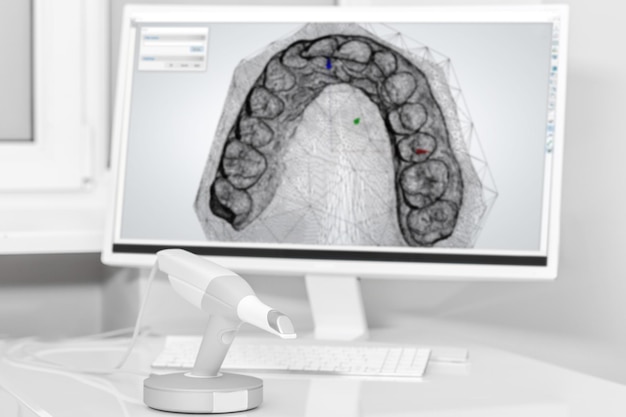 Escáner dental 3d y monitor en el consultorio de los dentistas