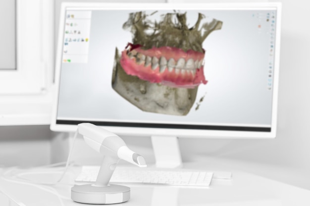 Escáner dental 3d y monitor en el consultorio de los dentistas