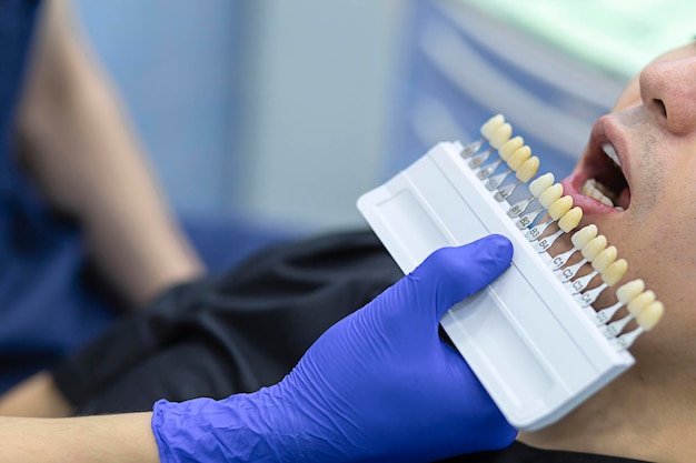 Foto escolha, seleção de cor de dentes de escala especial. o dentista seleciona a cor do esmalte do dente para o paciente.